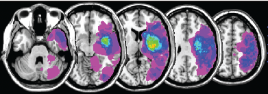 image of brain scans
