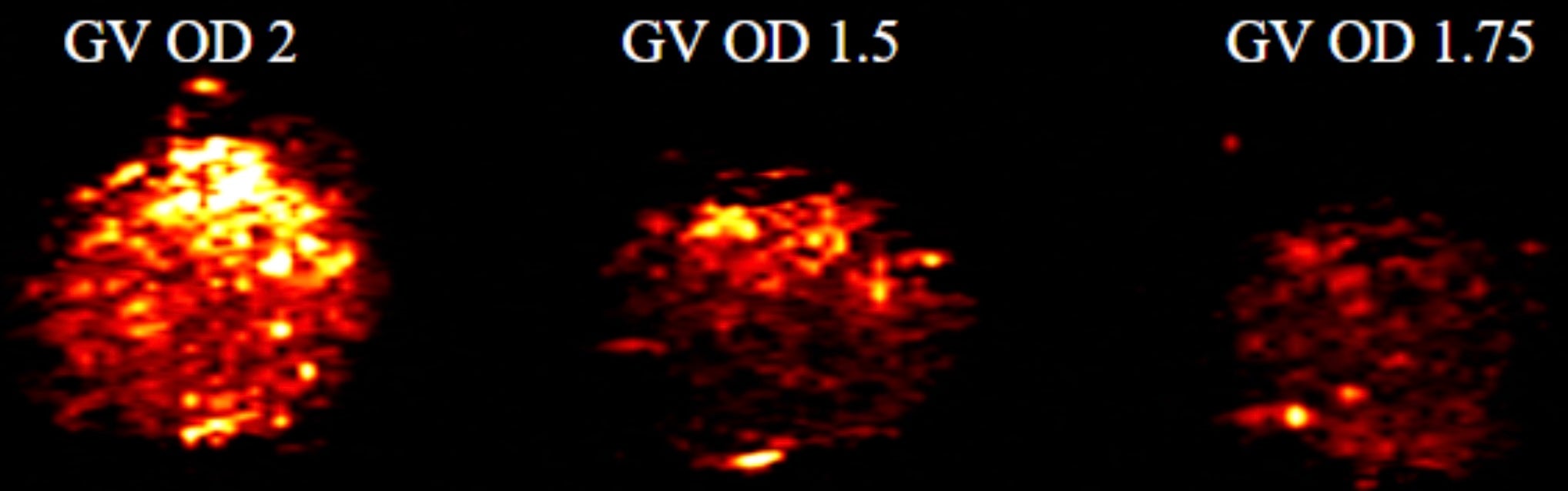 image of ultrasound data visualizing the collapse of Anabaena gas vesicle